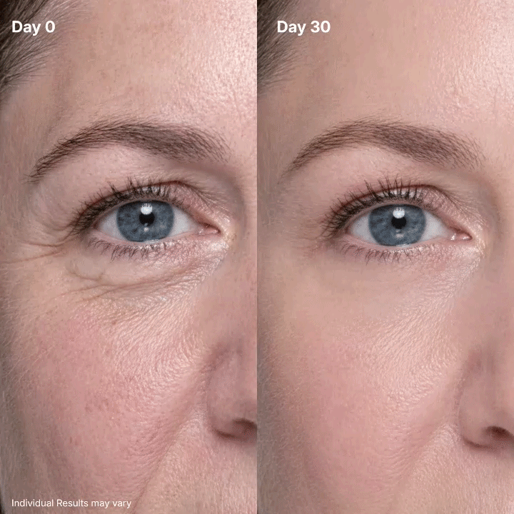✨ Discover Sabax® Eye Renewal Cream — Your Daily Eye-Care Ritual